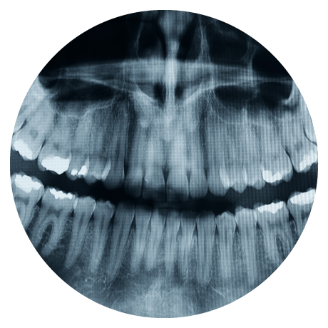 dental x-rays in edmonton