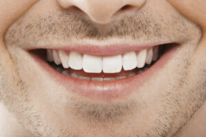 How to Whiten Teeth.