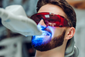 Man having teeth whitening by dental UV whitening device, dental.