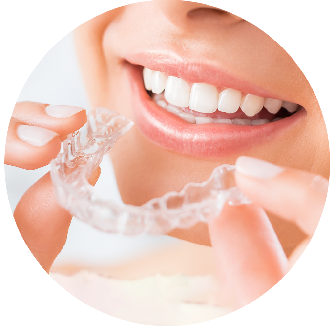 Up close image of Invisalign and teeth.