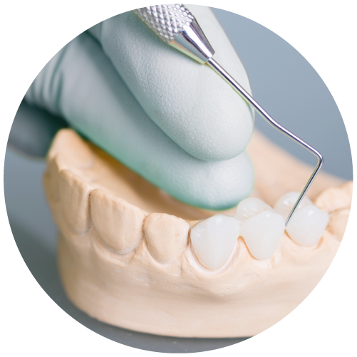 up close image of a dental bridge.