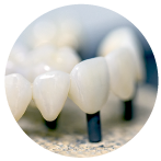 Ceramic Dental Crown.